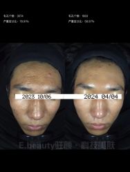 -E.beauty驻颜·痘敏肌调理中心