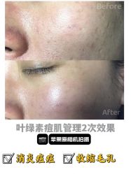 -E.beauty驻颜·痘敏肌调理中心