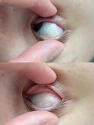 -肌理言健康美肌驻颜所