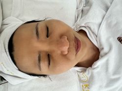 体验后-康美贞·痘肌养护管理中心