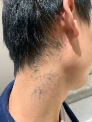 -杭州米兰柏羽医疗美容医院