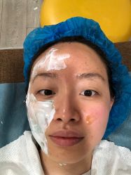 体验前-上海时光整形外科医院