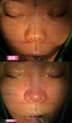 -北京米扬丽格医疗美容·联合丽格鼻整形中心