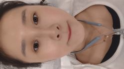 体验后-原力医疗美容