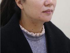 -柏乐口腔(南宁总院)