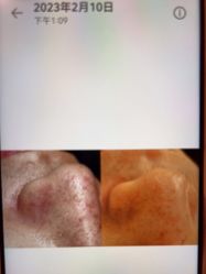 -苑苑vbeauty科技美容SPA