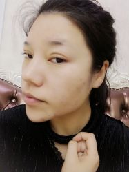 体验前-西安壹加壹医疗美容·西北抗衰旗舰店