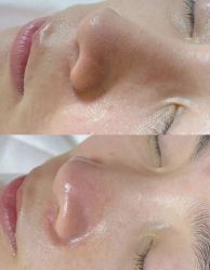 -美愈美肤MEIYU SKIN