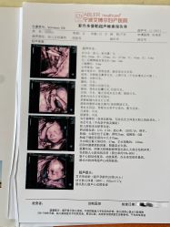 -艾博尔医院