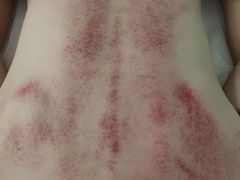 -麻麻手推拿