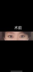 体验前-大连美天医疗美容医院
