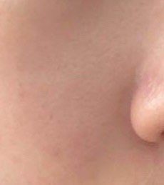 -比华利美容医院