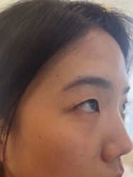 -长沙雅美医疗美容医院