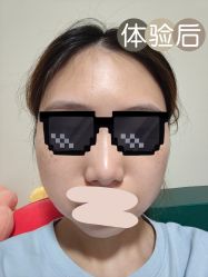 体验后-深圳美莱医疗美容医院