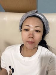 点击看大图 体验后-臻悦医疗美容整形门诊部
