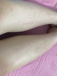 -顺德壹加壹美容医院