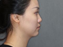 -齐玉齿科JADENTAL