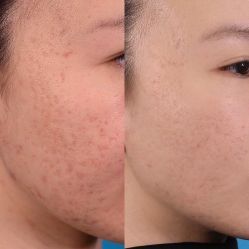 -SKINIST丽铂医疗美容