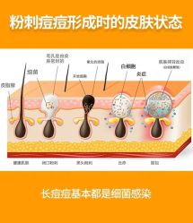 -苗方清颜痘肌研究所