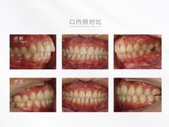 -齐玉齿科JADENTAL