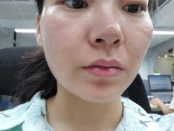 -洁铭新加坡医美