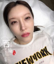 点击看大图 -西施无菌半永久纹绣眉眼影唇轻增发纹发际线