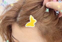 -大麦微针植发全国连锁