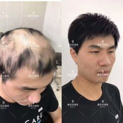 -唐风采假发补发定制