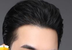 -大麦微针植发丨全国连锁