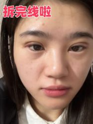 -素美医疗美容·西南眼鼻整形·修复基地