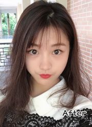-小忠丽格医美