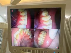-赫尔森口腔·牙齿种植修复