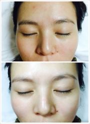 点击看大图 -美肤盾祛痘·问题肌头疗管理中心