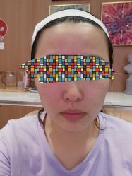 -深圳艺星医疗美容医院