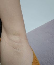 -杭州米兰柏羽医疗美容医院