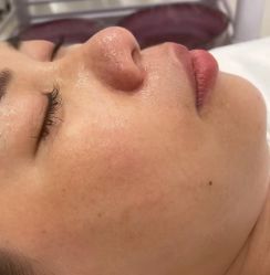 -杭州米兰柏羽医疗美容医院