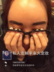 刚做完-LEYA皮肤管理