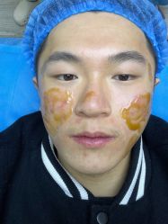 体验后-重庆联合丽格第五医疗美容医院