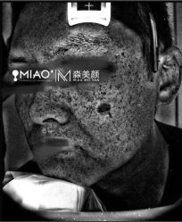 -韩国淼美颜皮肤管理官方直营店