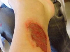 -莱蔻·圣灸堂·推拿艾灸(天山店)