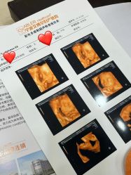 -艾博尔医院