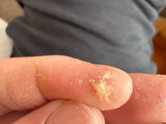 -郑远元专业修脚房·按摩·肉刺·灰指甲(郭新东路店)