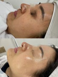 -美愈美肤MEIYU SKIN