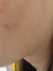 -美瑞莎创美医疗美容