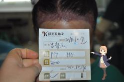 点击看大图 -大麦微针植发丨全国连锁