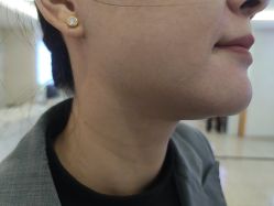 -长沙雅美医疗美容医院