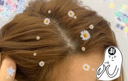 -大麦微针植发全国连锁