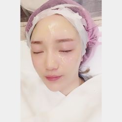 体验后-上海星和医疗美容