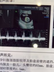 -上海百佳妇产医院