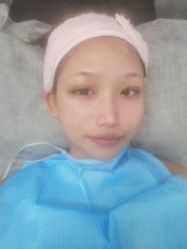 -KS科逆美肤祛痘